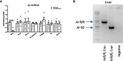 Comparison of Reproductive Function Between Normal and Hyperandrogenemia Conditions in Female Mice With Deletion of Hepatic Androgen Receptor